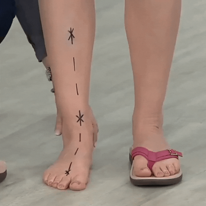 Sigrid | Orthopaedic Summer Sandals